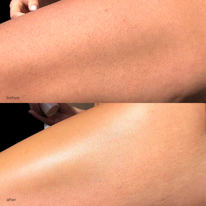 sérum glo-up